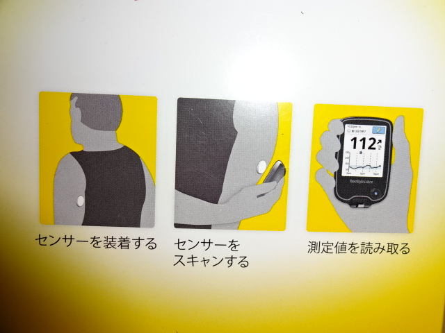 血糖値測定器フリースタイルリブレ